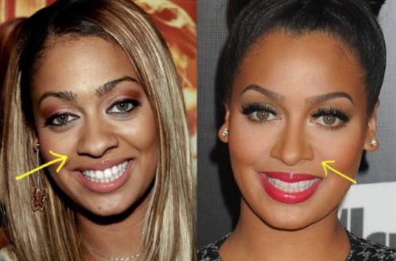 lala anthony before and after plastic surgery